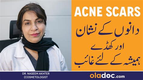 Remove Pimple Marks From Face Danon Ke Nishan Khatam Karne Ki Tips