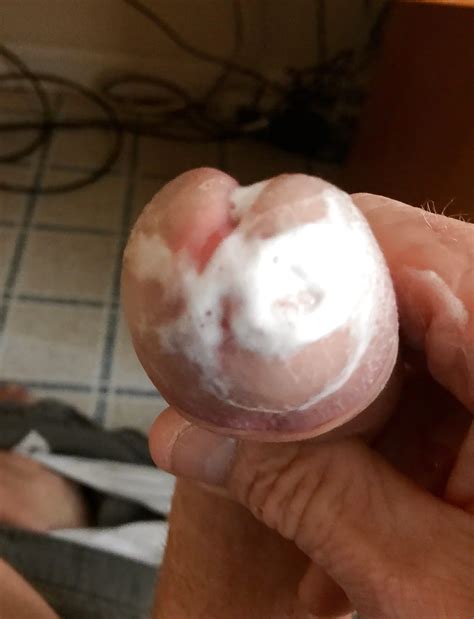 Head Wet With Precum 17 Nude Pics XHamster