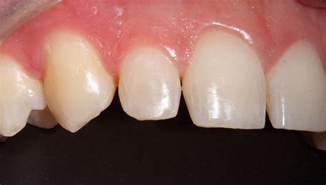 Soll Fig 5a Oral Health Group