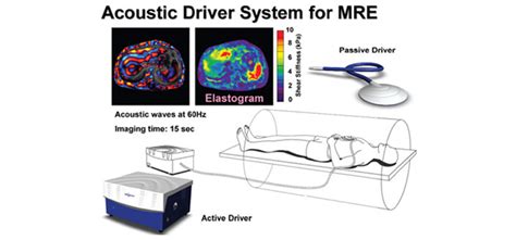 MRI Elastography and the Fight Against Obesity - Radiating Hope