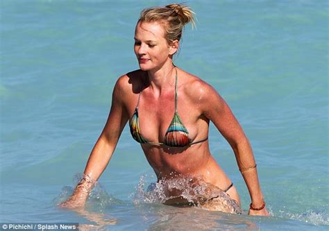 Bikini Girl Anne Vyalitsyna Displays A Painful Looking Red Stomach And