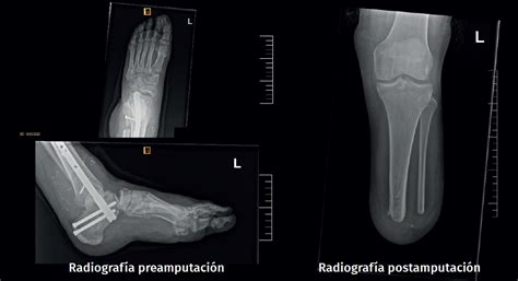 Retla Fs Figura Png Fondoscience