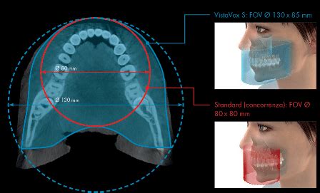 Vistavox S Cbct Vol X Medical Technology Solution