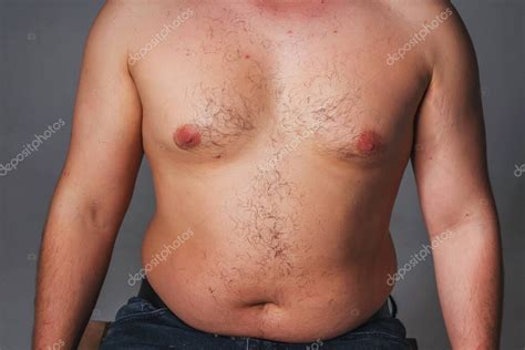 Torso Masculino Con Sobrepeso Torso Desnudo De Un Hombre Aumento De