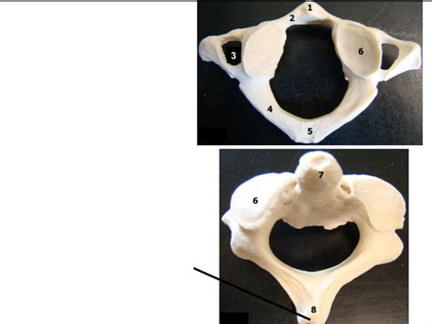 atlas and axis vertebrae (lab midterm) Diagram | Quizlet