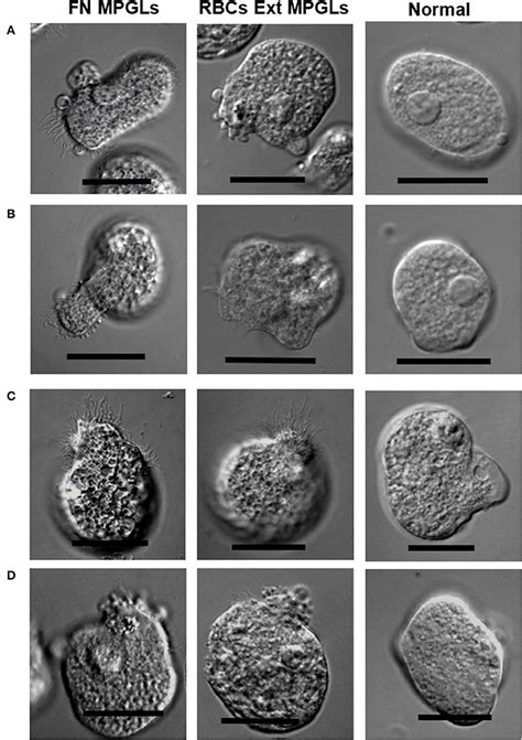 Entamoeba Histolytica Morphology