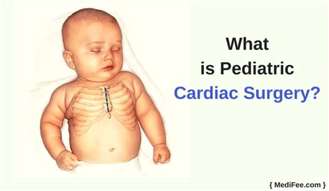 Treating Congenital Heart Defects - Pediatric Cardiac Surgery