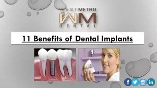 Ppt Benefits Of Dental Implants Powerpoint Presentation Free