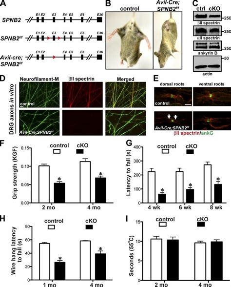 Generation And Characterization Of Mice Lacking Ii Spectrin In Sensory