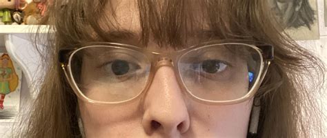 I Have A Mild Strabismus My Glasses Are Supposed To Help Correct It Is It Still Noticeable