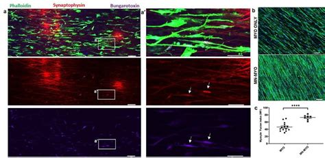 Innervation Of Myocytes And Effect Of Motor Neurons On Myocyte