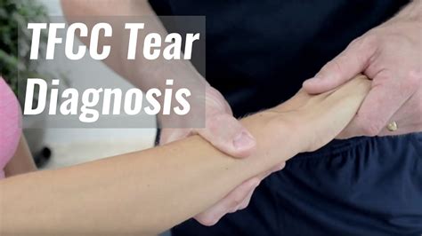 Tfcc Tear Diagnosis Youtube