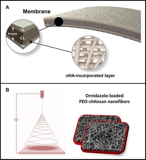 Electrospun Nanofibers For Periodontal Treatment Ijn