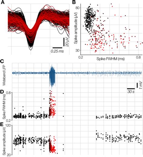 Example Wave Shape Changes At Ictal Recruitment In Template Matched