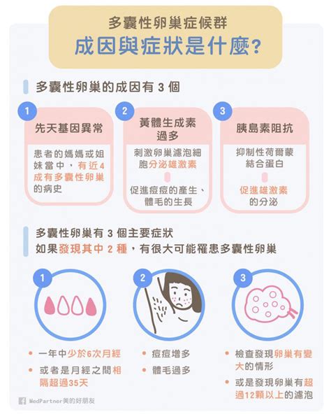 多囊性卵巢症候群怎麼辦？醫師教你根據症狀治療保健 Medpartner 美的好朋友 健康遠見