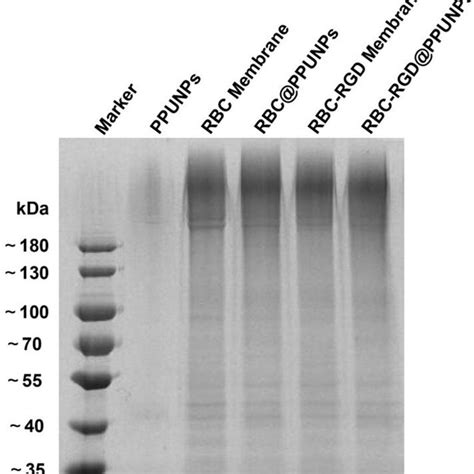 The Sds Page Gels Images Of Ppunps Rbc Membrane Rbcm Ppunps Rgd Rbc