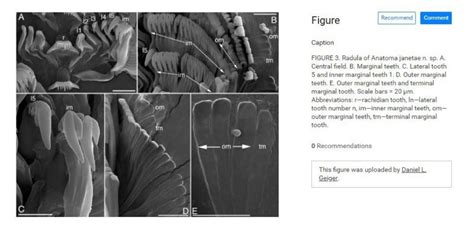 Phylum: Mollusca & their radula | Cephalopod Radula under the SEM