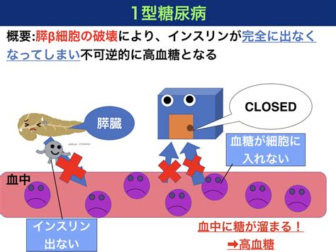 糖尿病ケトアシドーシスとは？機序や症状、病態をわかりやすく解説！