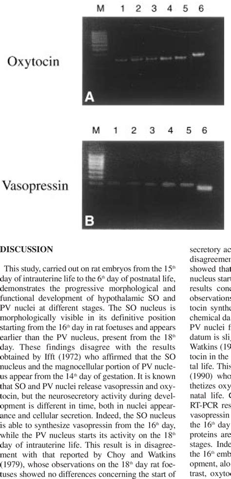 Agarose Gel Electrophoresis Of Rt Pcr Products The Figure Shows