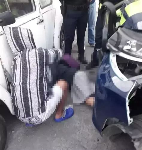 Patrulla De Puebla Capital Atropella A Estudiante En Analco Ambas Manos