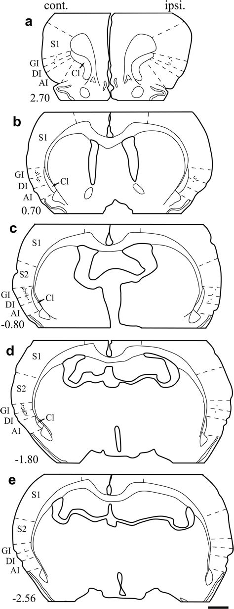 Projections From The Insular Cortex To Pain Receptive Trigeminal Caudal