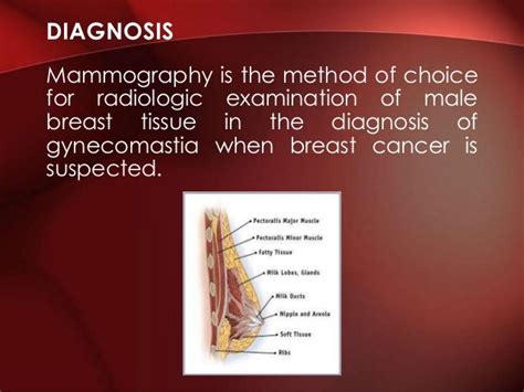 Gynecomastia Surgery Ppt