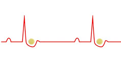 Digoxin Toxicity Ekg Findings For Early Treatment A Practical Guide In