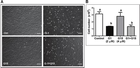 The Gper Antagonist G Does Not Attenuate The Inhibitory Effect Of G