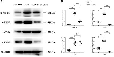 Excessive Glucocorticoids Combined With Rankl Promote The