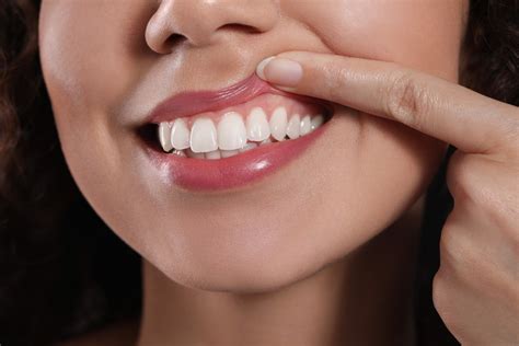 How To Maintain Healthy Gums Tips For Gum Care Care For Yoo