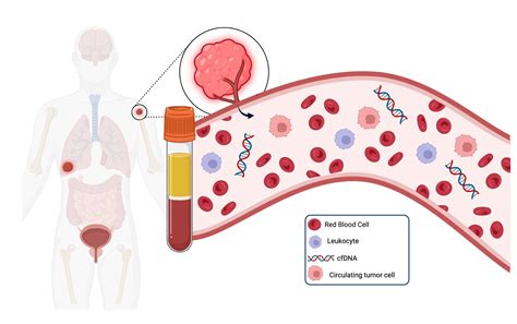 Understanding Circulating Tumor Cell Based Liquid Biopsy Bloodpac