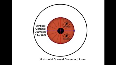 Cornea Definition Diameter Of Cornea Youtube