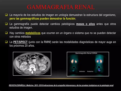 Estudios Complementarios Gammagrafia Renal Ppt