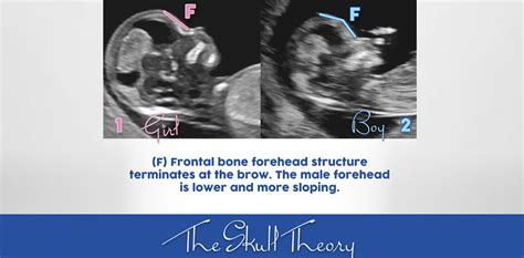 The Skull Theory - The Physical Attributes of your Baby's Skull Matter ...