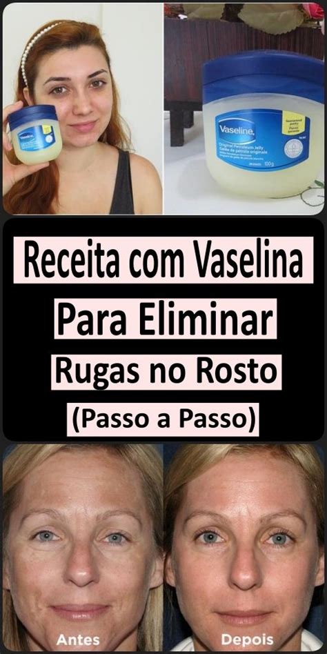 Receita Vaselina Para Eliminar Rugas No Rosto Passo A Passo