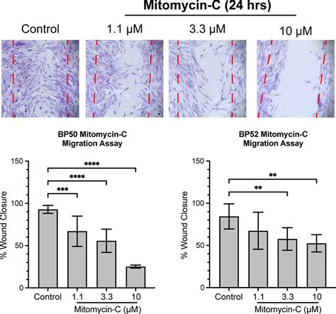 Effects Of Mitomycin C And 5 Fluorouracil On Ocular Adnexal Sebaceous