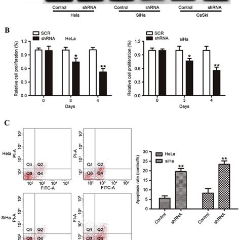 FOXC1 Silencing Inhibits Cervical Cancer Cell Growth In Vitro A