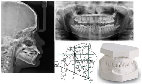 C Mo Se Realiza Un Estudio De Ortodoncia Cl Nica Dental Ramis Gand A