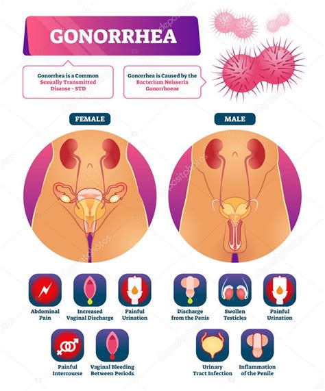 Ilustraci N Vectorial De Gonorrea Lista De S Ntomas De Explicaci N De