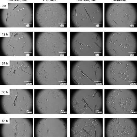 Short Anthophyllite And Tremolite Fibers Are Phagocytosed And Localized