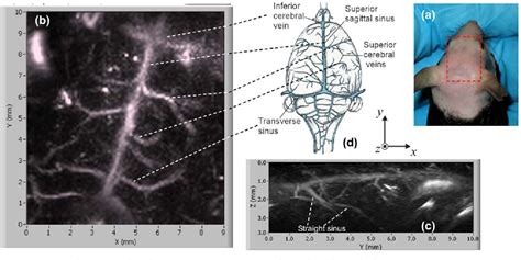 Figure 1 From Three Dimensional Photoacoustic Imaging Of Vascular