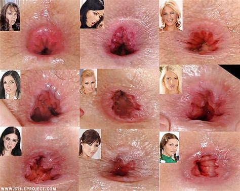 Assholes Porn Pictures XXX Photos Sex Images PICTOA