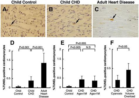 Detection Of Tunel Positive Cardiomyocytes And C Kit Positive