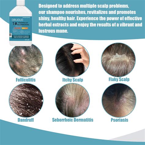 Folliculitis Shampoo Seborrheic Dermatitis Shampoo Anti Dandruff Shampoo