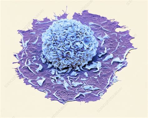 Macrophage SEM Stock Image C041 2316 Science Photo Library