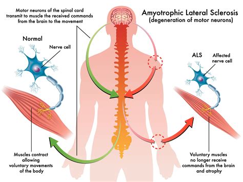 Amphetamines - Vancouver Home Health Care Agency