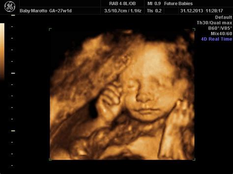 3d Image Of Baby At 27 Weeks - the meta pictures