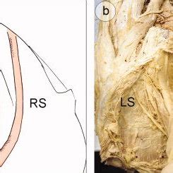 Dissection of the retropubic space in an 85-year-old female pelvis,... | Download Scientific Diagram