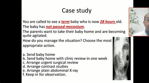 Case 77 failure to pass meconium, delayed passing stool, meconium plug syndrome, bowel ...