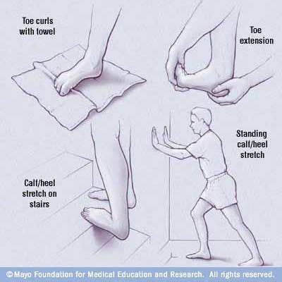 Swirlster First: Tendonitis Foot Exercises